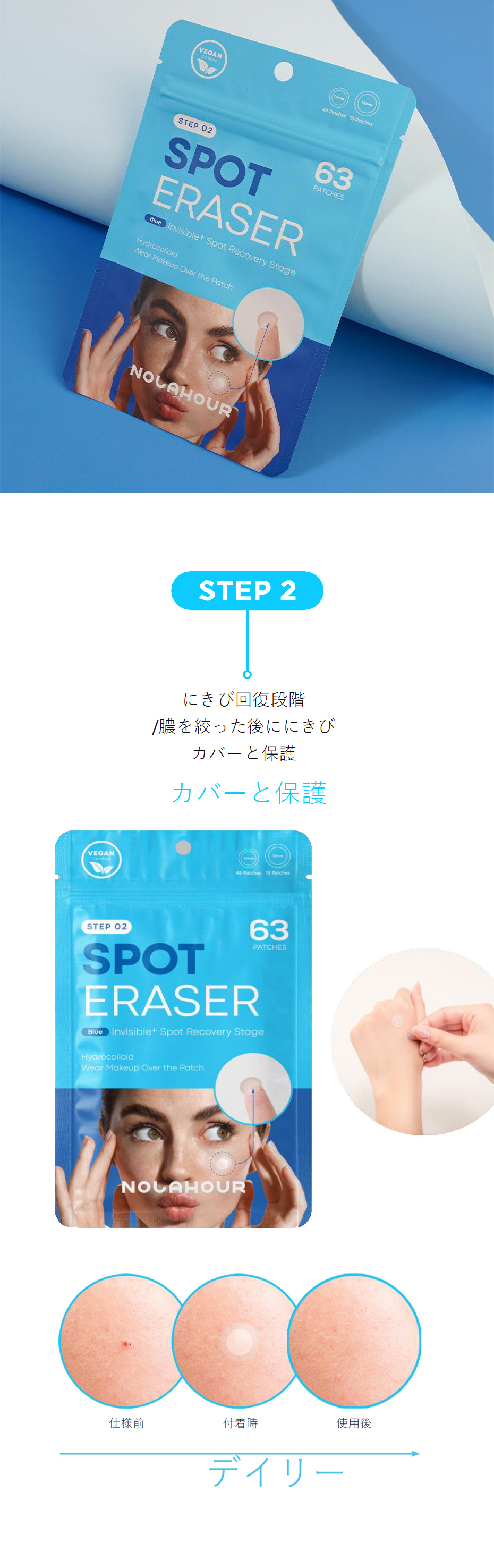 [NOLAHOUR] ニキビパッチ スポットイレイザー / 63枚入り ブルー step2 純度100％ ハイドロコロイドパッチ にきびパッチ 超薄型 目立たない #クリックポスト